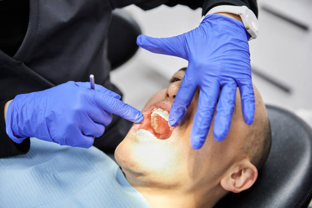 Best Emergency Wisdom Tooth Extraction in Hustisford, WI